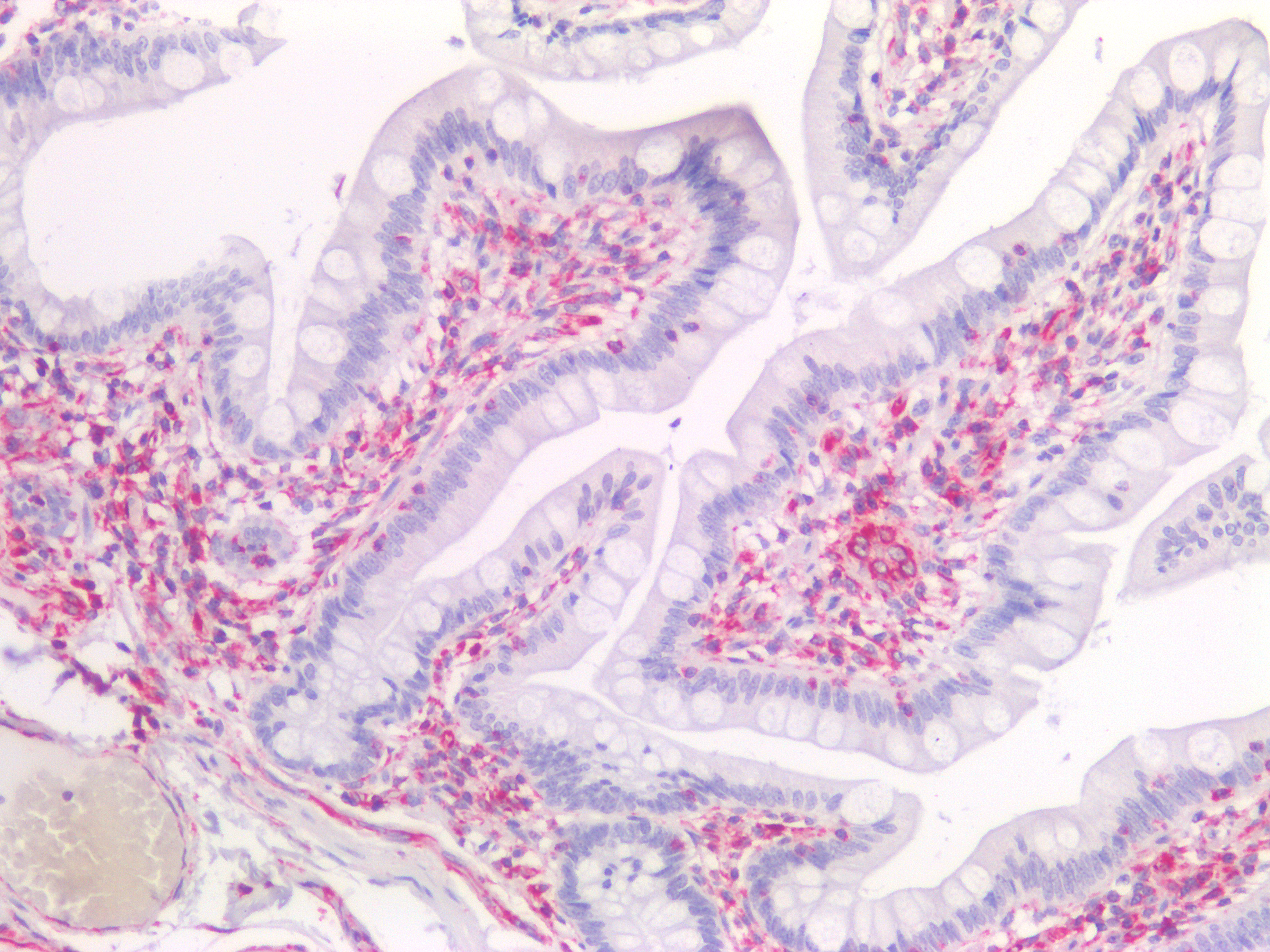 Figure 8. Immunostaining of human paraffin embedded tissue sections of human small intestine with MUB1904P (diluted 1:200), showing the specific pattern of vimentin in the mesenchymal cell types, such as fibroblasts in the connective tissue. As expected, no reactivity is seen in the epithelial cell compartment.